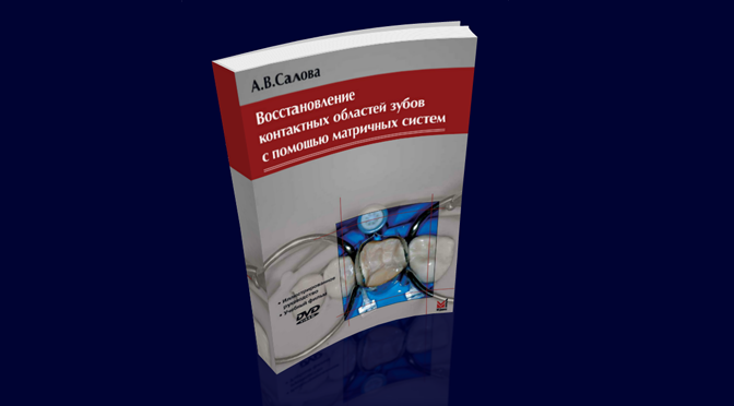 Восстановление контактных областей зубов с помощью матричных систем – Салова А.В.