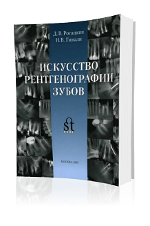 Искусство рентгенографии зубов – Рогацкин Д.В., Гинали Н.В.